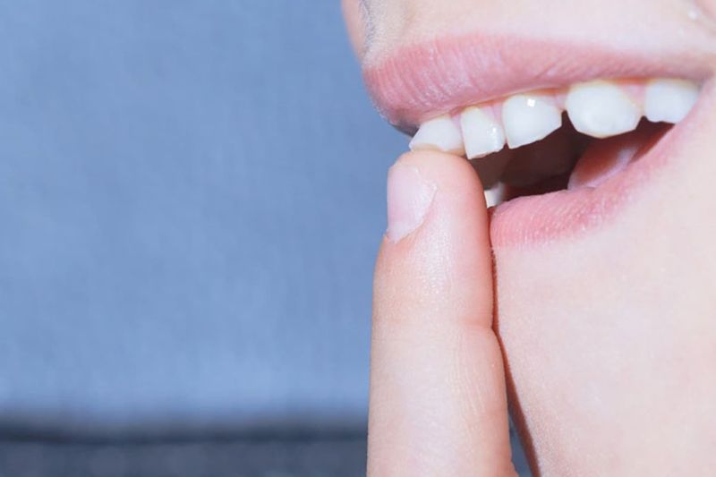 Nhổ răng sữa cho trẻ và những điều phụ huynh cần lưu ý Răng sữa lung lay là dấu hiệu răng cần được nhổ