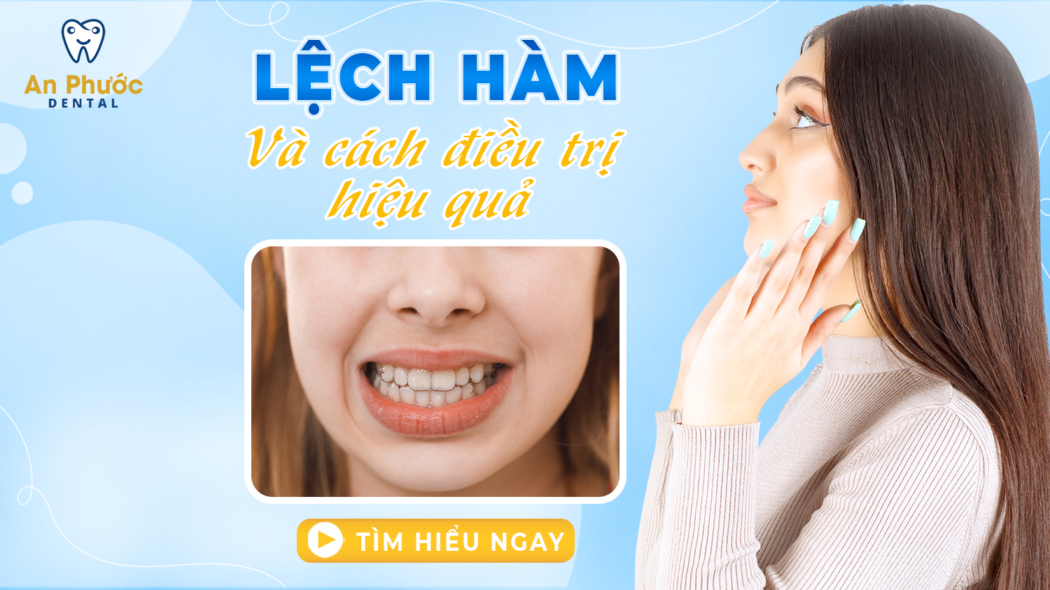Lệch hàm: Nguyên nhân, tác hại và phương pháp điều trị hiệu quả