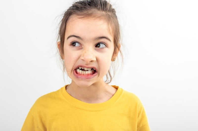 Lệch hàm: Nguyên nhân, tác hại và phương pháp điều trị hiệu quả Tình trạng lệch hàm