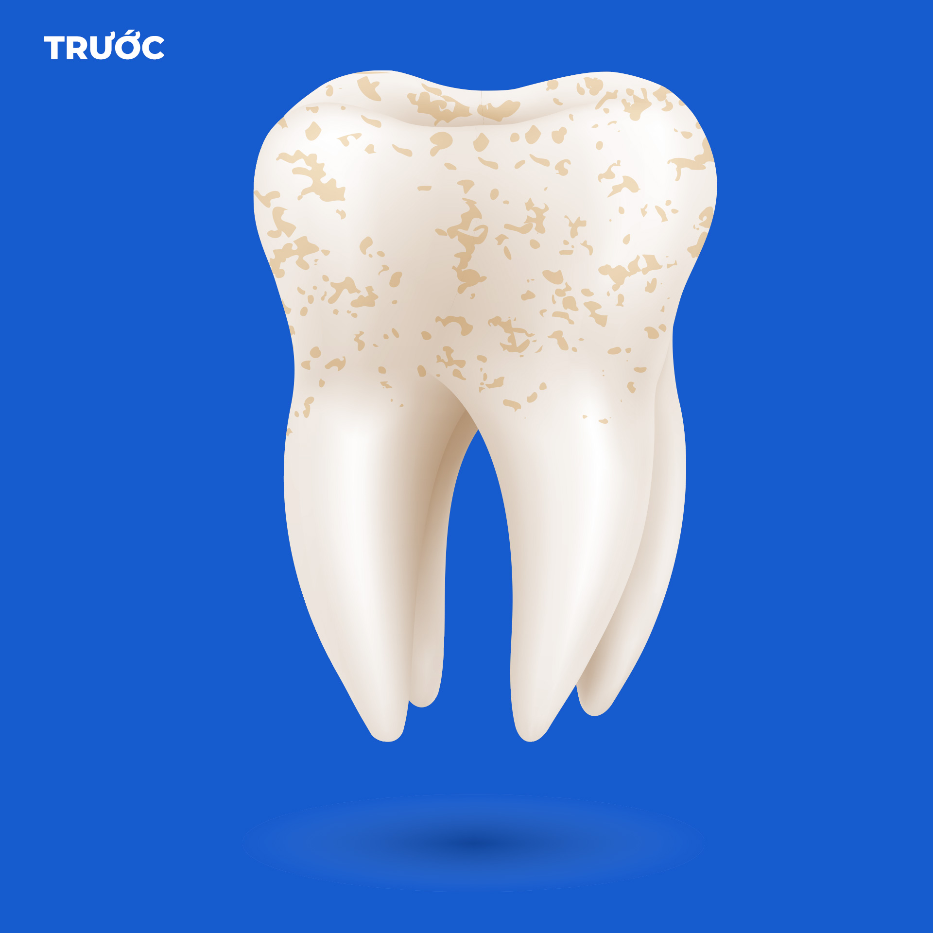 cao voi rang bf Tháng mười một 18, 2025