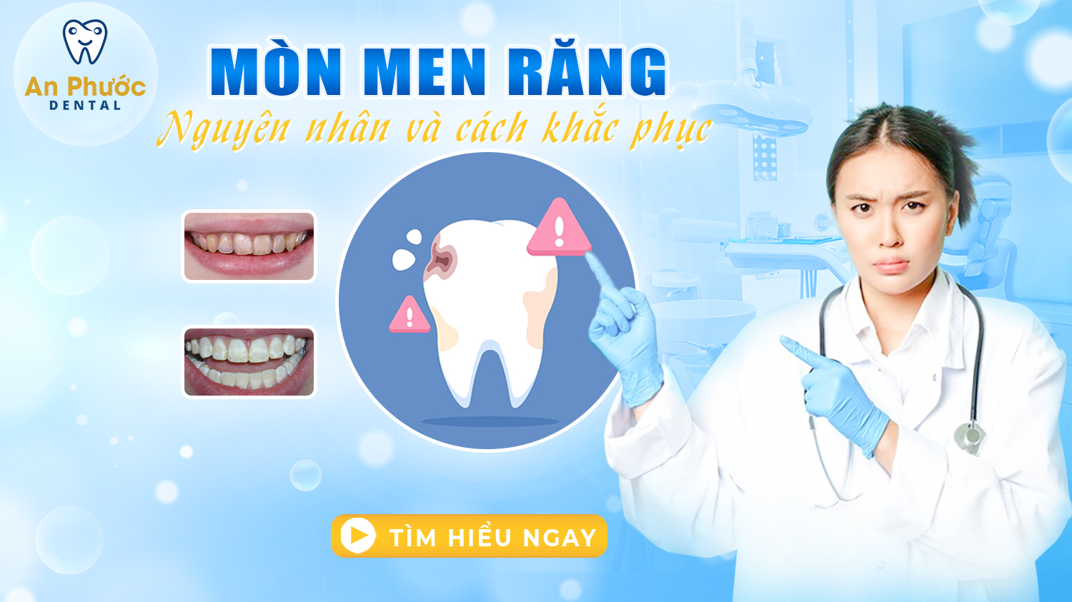 mon-men-rang-nguyen-nhan-va-giai-phap