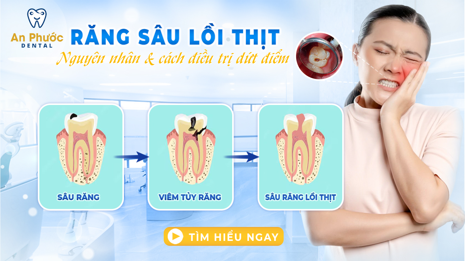 Răng sâu lồi thịt là gì? Nguyên nhân, tác hại và cách điều trị rang-sau-loi-thit-nguyen-nhan-va-cach-chua-tri