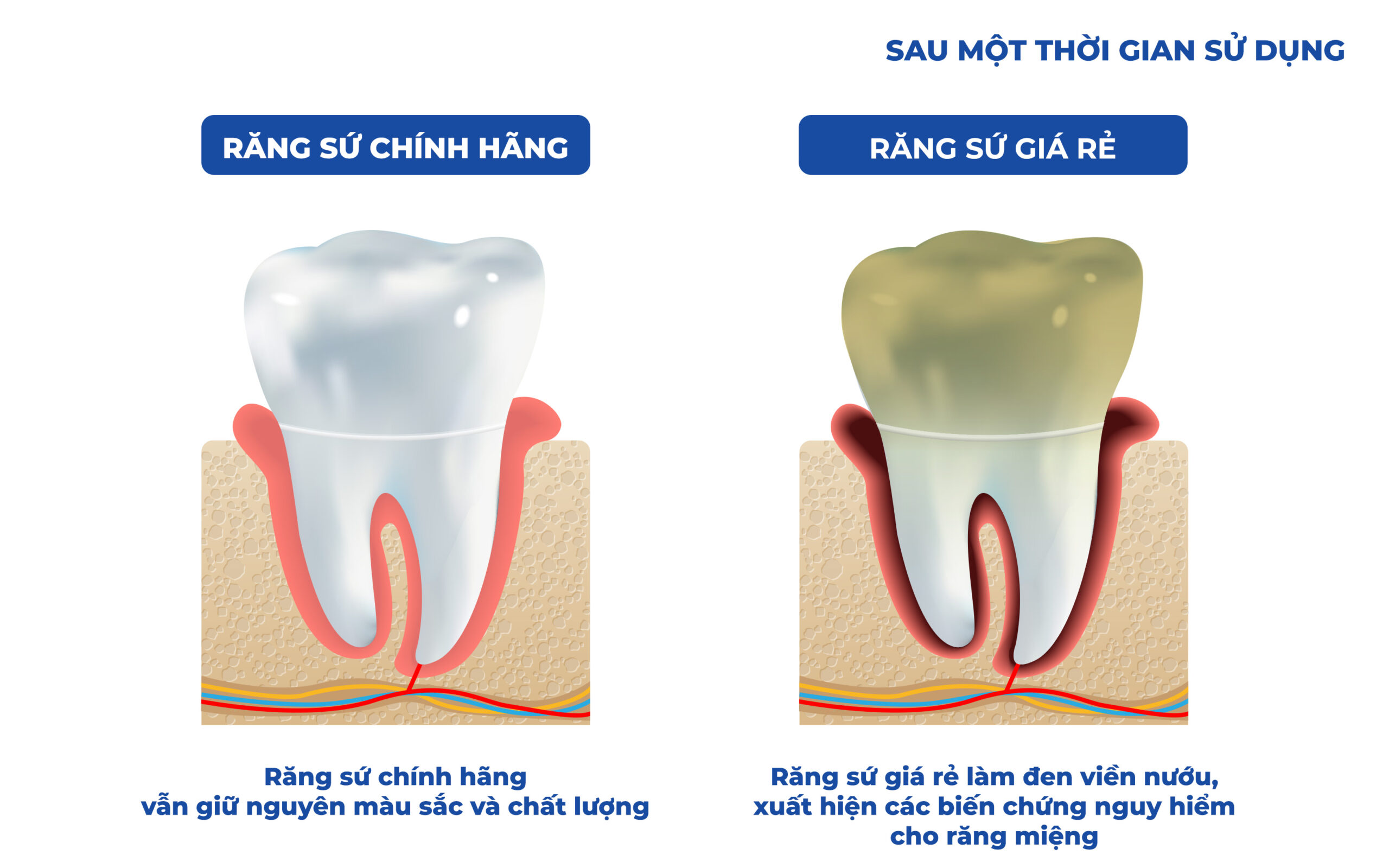 rang su af scaled Tháng 4 15, 2026