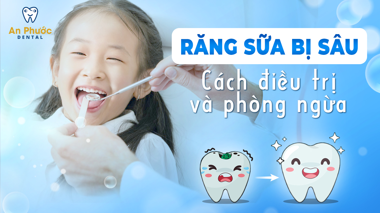 rang-sua-bi-sau-cach-dieu-tri-va-phong-ngua