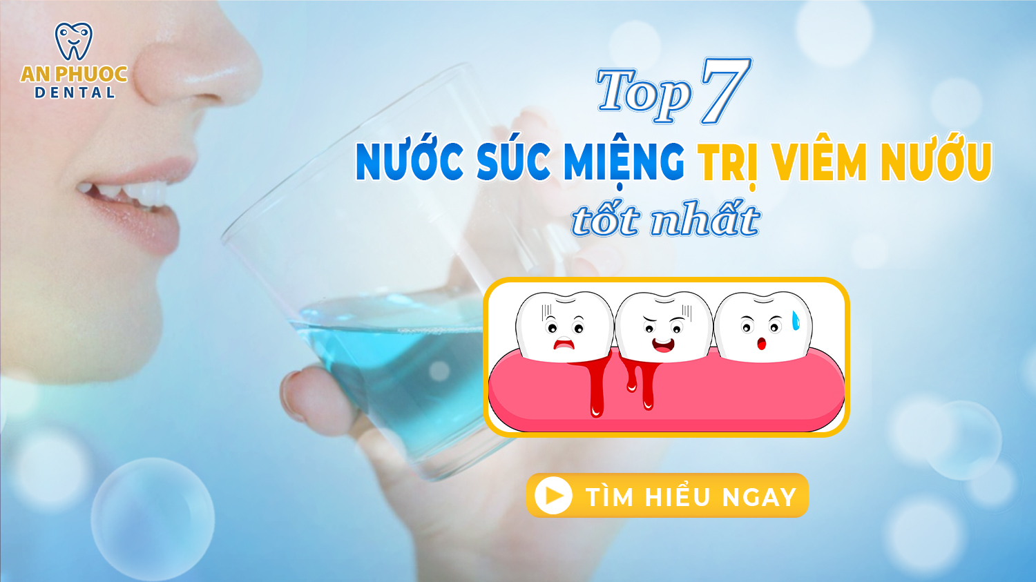 Top 7 nước súc miệng trị viêm nướu hiệu quả nhất hiện nay