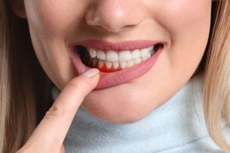 Răng bọc sứ bị đau nhức do đâu? Làm gì để hết đau? Bệnh lý răng miệng không điều trị triệt để là một nguyên nhân gây đau nhức khi bọc sứ