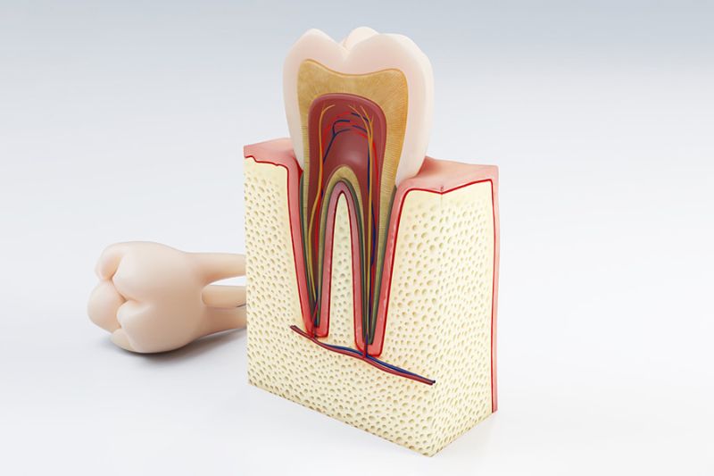 Răng bọc sứ bị đau nhức do đâu? Làm gì để hết đau? Răng chưa được điều trị tuỷ dứt điểm sẽ gây đau nhức sau khi bọc sứ