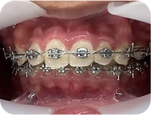 Trải nghiệm khách hàng NGHUNG BF Tháng 10 23, 2025