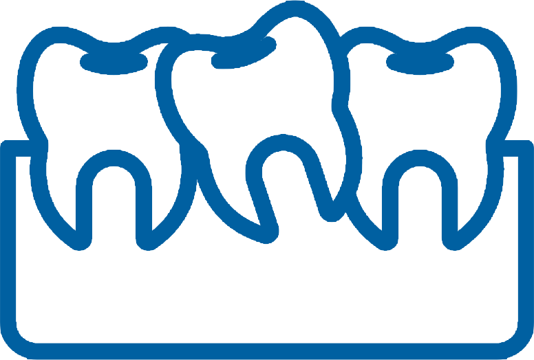 Bảng giá niềng răng 2025 icon Muc do lech lac Tháng 10 16, 2025