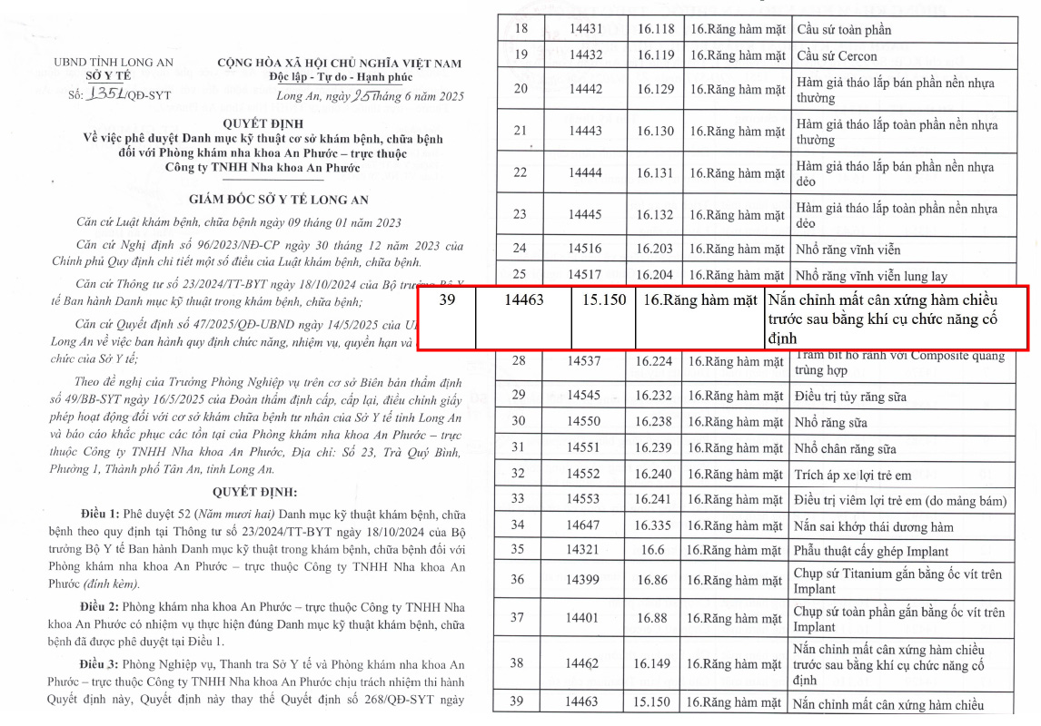 Niềng răng trong suốt SYTNiengrang 2 Tháng 10 26, 2025