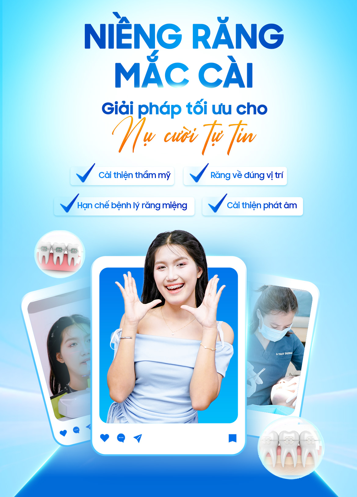 Nieng rang mac cai Giai phap toi uu cho nu cuoi tu tin 3 Tháng 3 23, 2026