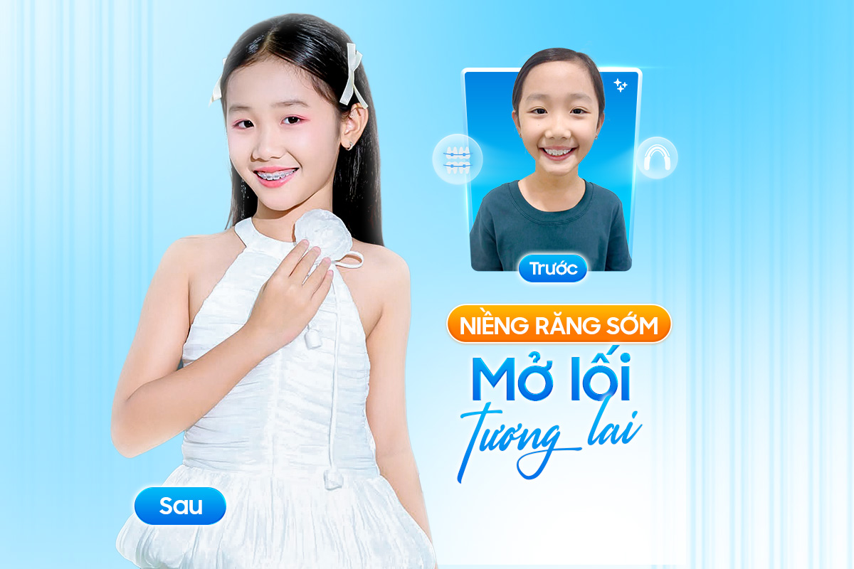 272_[WEB]-SAO-NHÍ-NIỀNG-RĂNG