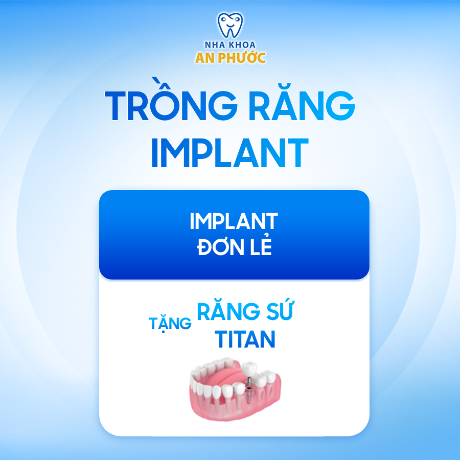 Ưu đãi trồng răng tháng 1.2026